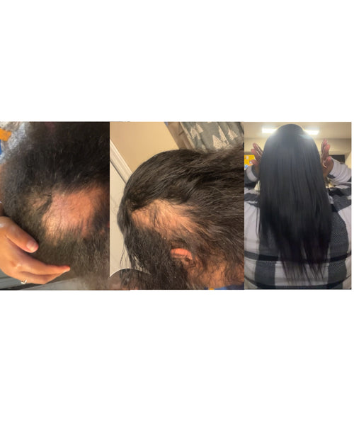 Stimulating hair growth oil